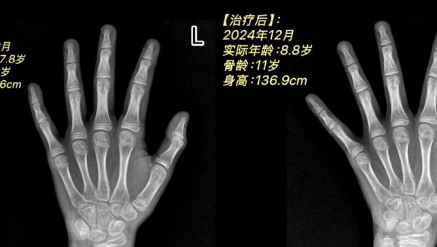 哪吒2票房已超冰雪奇缘,2o24年澳门六合免费资料大全,社会责任方案执行_户外版V10.66